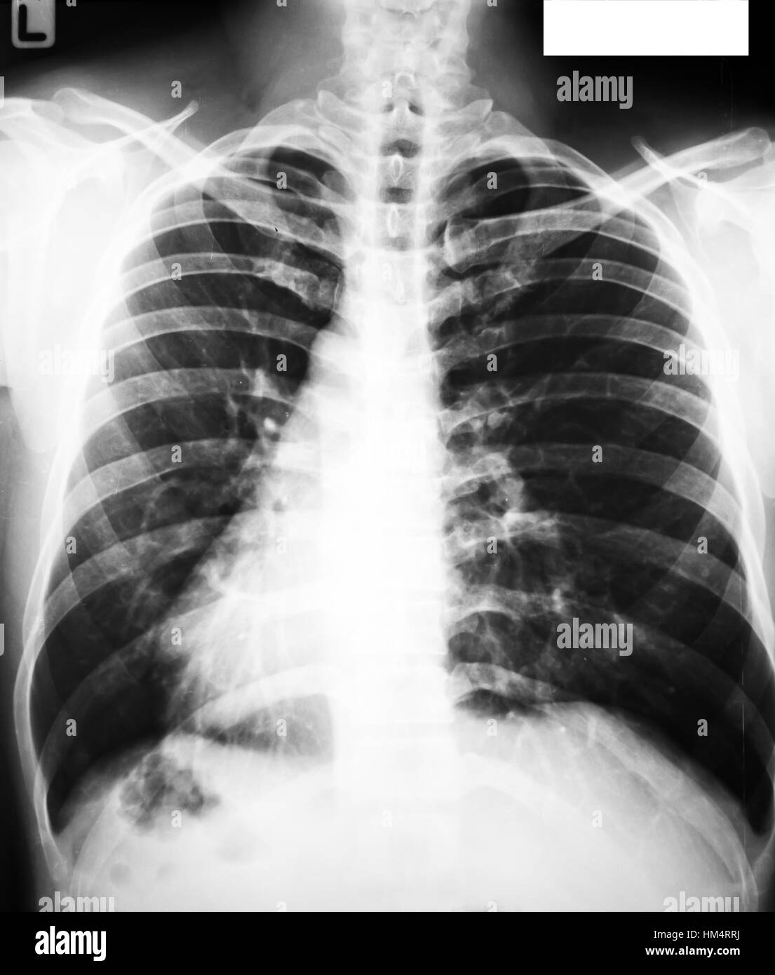 Sammlung von x-ray Stockfoto