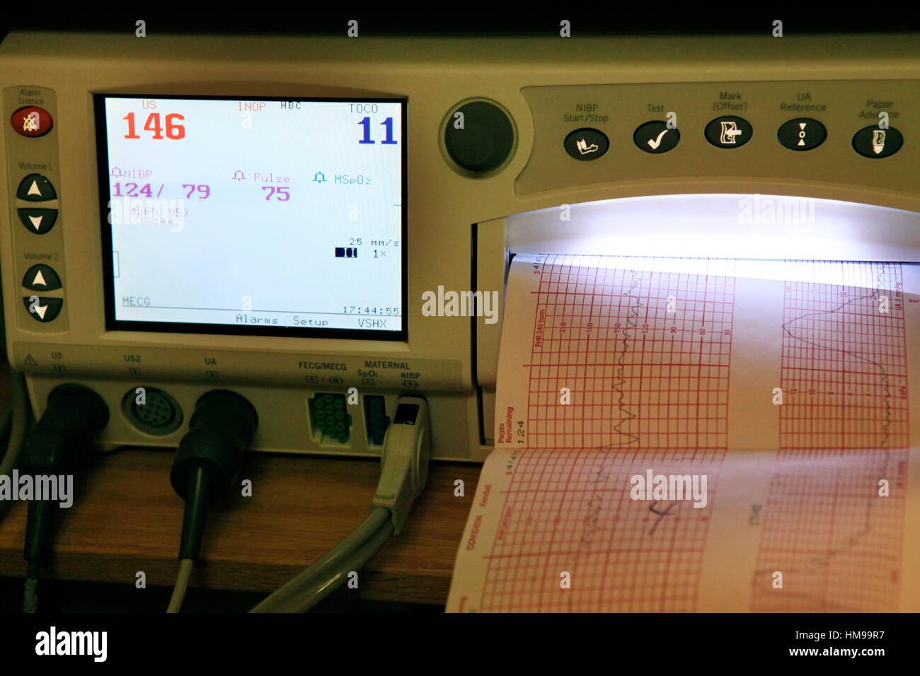 Gerät misst den Puls der Herzschlag des Babys im Mutterleib mit Druck Stockfoto