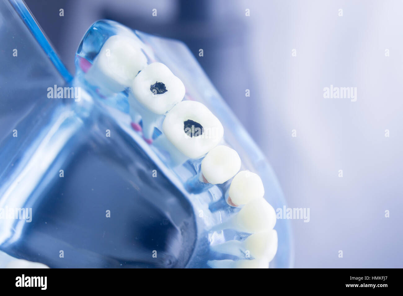 Dental Zahn Zahnmedizin Lernerfolge Lehrmodell zeigt Zähne, Wurzeln