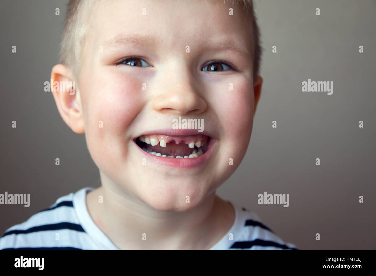 Kinder verlieren zähne Fotos und Bildmaterial in hoher Auflösung Alamy