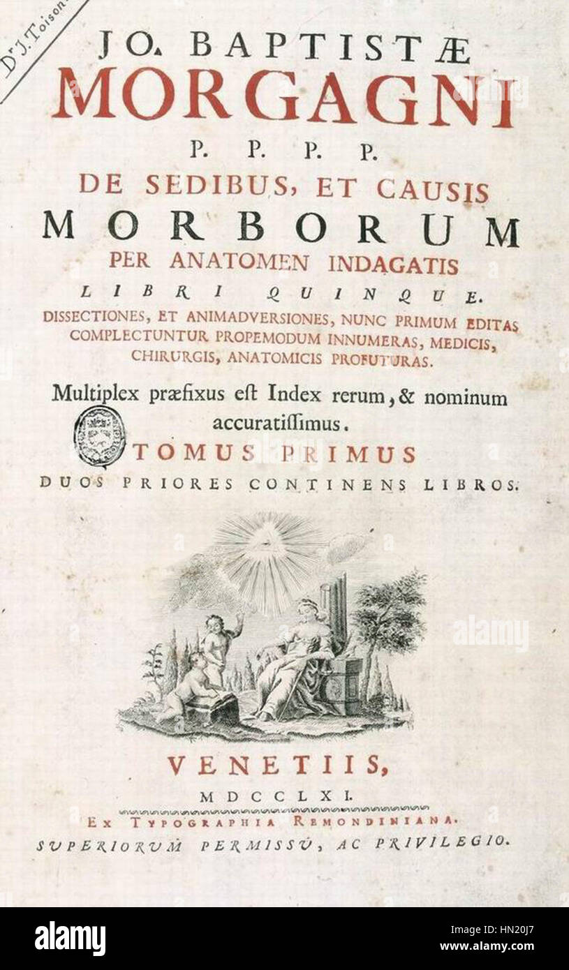 Morgagnis „de Sedibus“ (1761) ist ein Grundlagentext der medizinischen Geschichte, der die Erforschung der menschlichen Anatomie und der Ursachen von Krankheiten beschreibt. Die Arbeit vertiefte das medizinische Wissen und etablierte Prinzipien der modernen Pathologie erheblich. Stockfoto