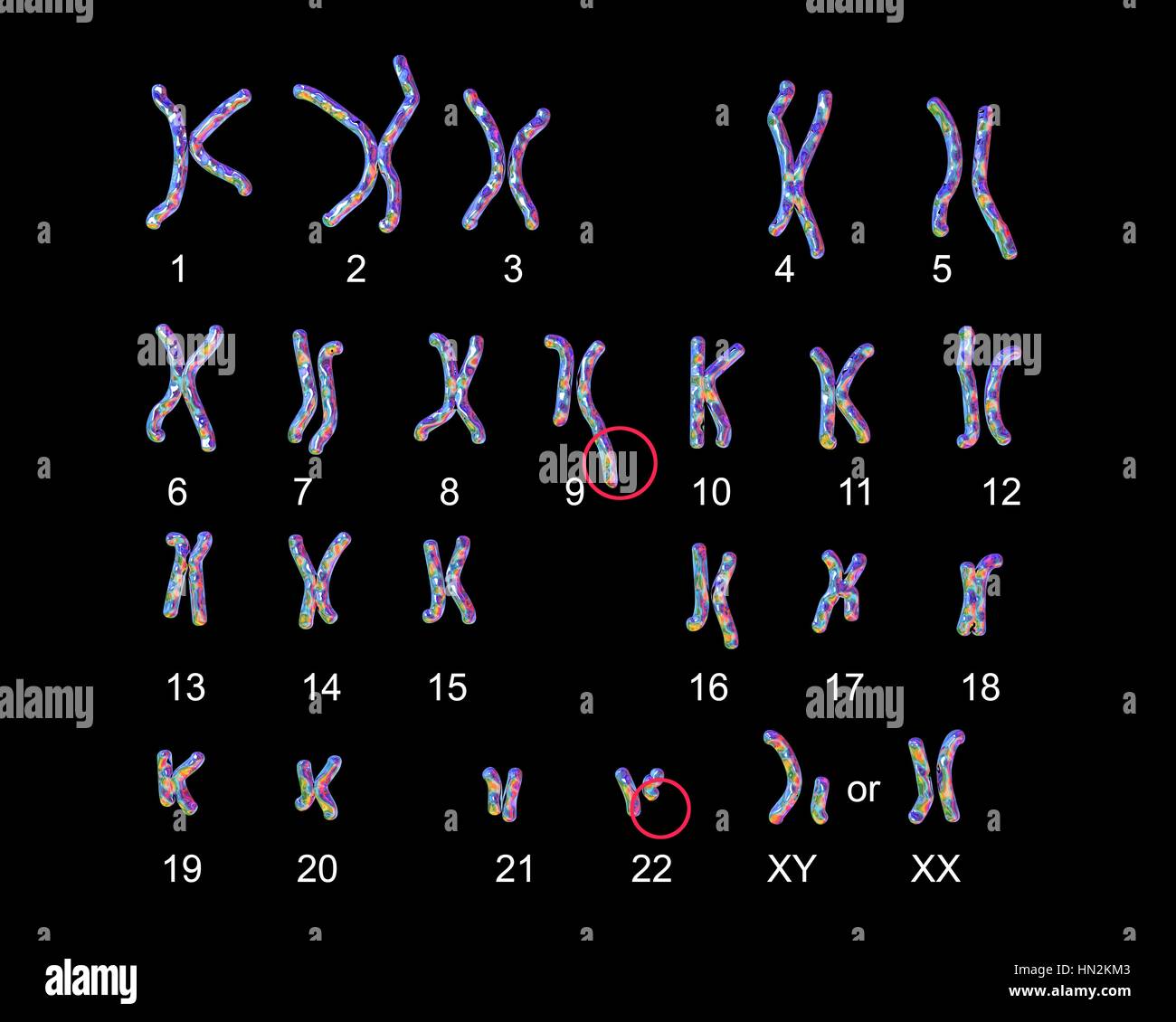 Philadelphia chromosome.Computer Darstellung der männlichen oder weiblichen Chromosomen (Chromosomensatz) einen defekten Chromosom jedes von Paaren 9 22. die Mängel am rechten Chromosomen von zwei Paaren, Ursache chronische myeloische Leukämie (CML). Die 46 Chromosomen des Menschen Karyotyp sind hier 23 paarweise angeordnet. Stockfoto Philadelphia chromosome.Computer Darstellung der männlichen oder weiblichen Chromosomen (Chromosomensatz) einen defekten Chromosom jedes von Paaren 9 22. die Mängel am rechten Chromosomen von zwei Paaren, Ursache chronische myeloische Leukämie (CML). Die 46 Chromosomen des Menschen Karyotyp sind hier 23 paarweise angeordnet. Stockfoto
