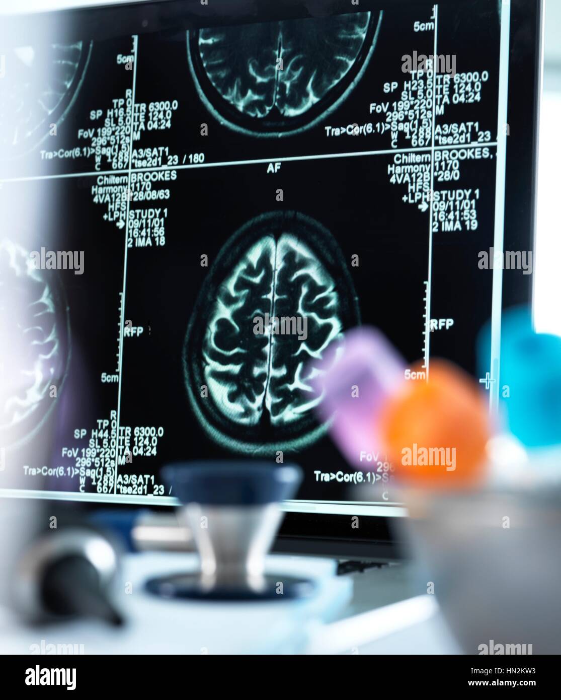 Magnetic Resonance imaging (MRI)-Gehirn-Scans auf einem Bildschirm auf einen Arzt Schreibtisch angezeigt. Stockfoto