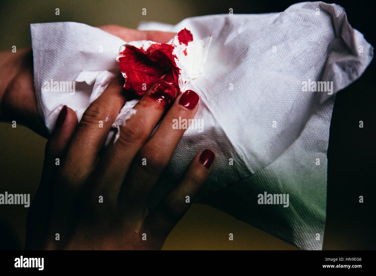 Blutige Hand nach dem Schneiden mit Serviette, um Blut aufzusaugen Wunde beim Bartending von zerbrochenem Glas Stockfoto