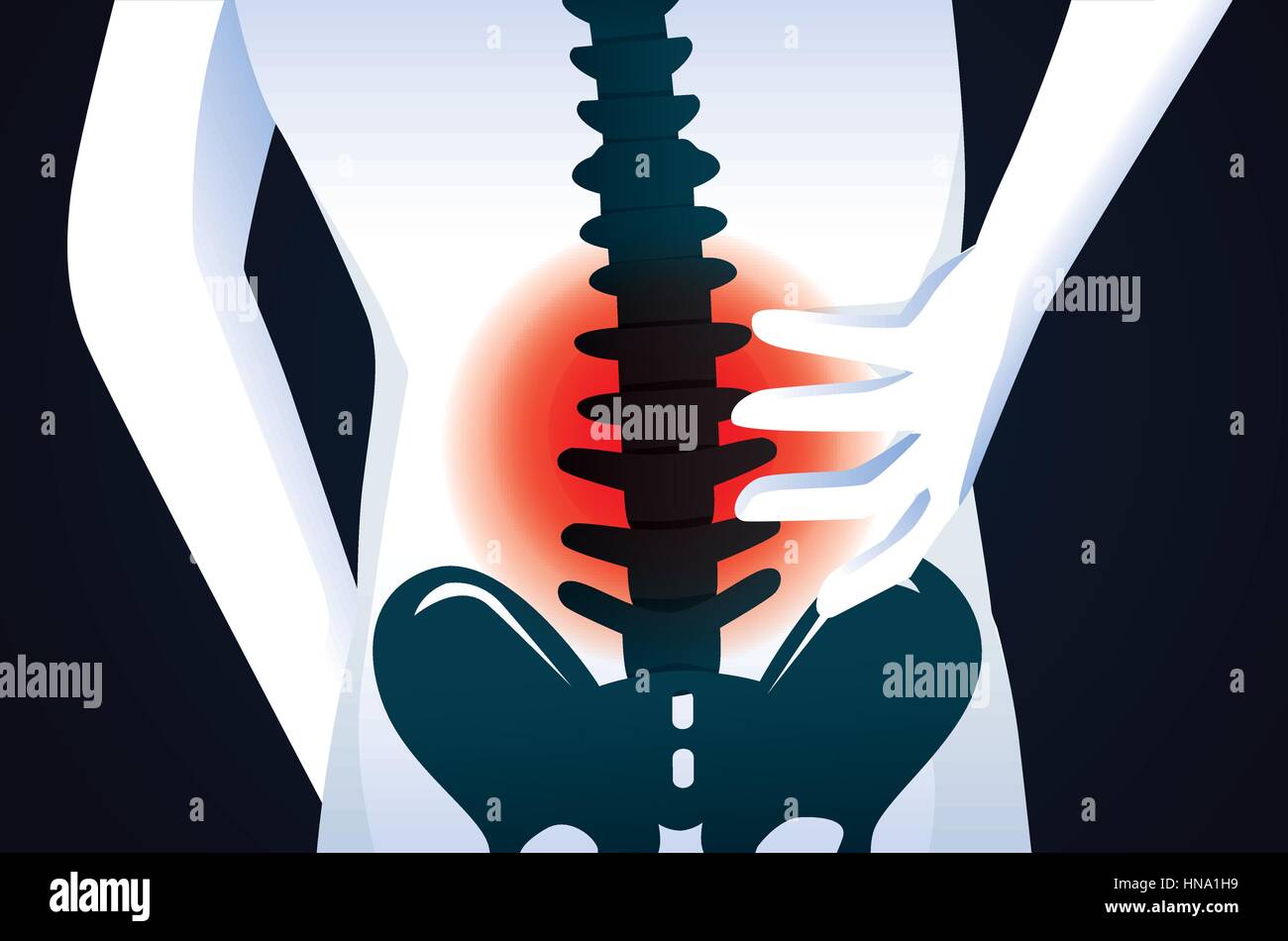 Rotes Signal im Bereich der Wirbelsäule. Diese Illustration über menschliche Rückenschmerzen. Stock Vektor