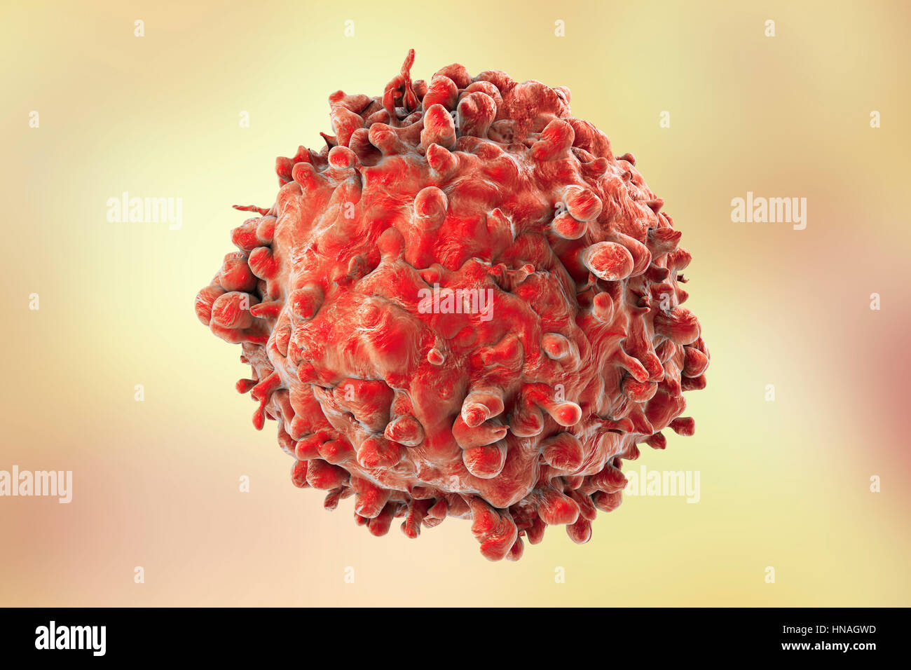 Computer-Illustration von krebsartigen weiße Blutzellen bei Leukämie. Stockfoto