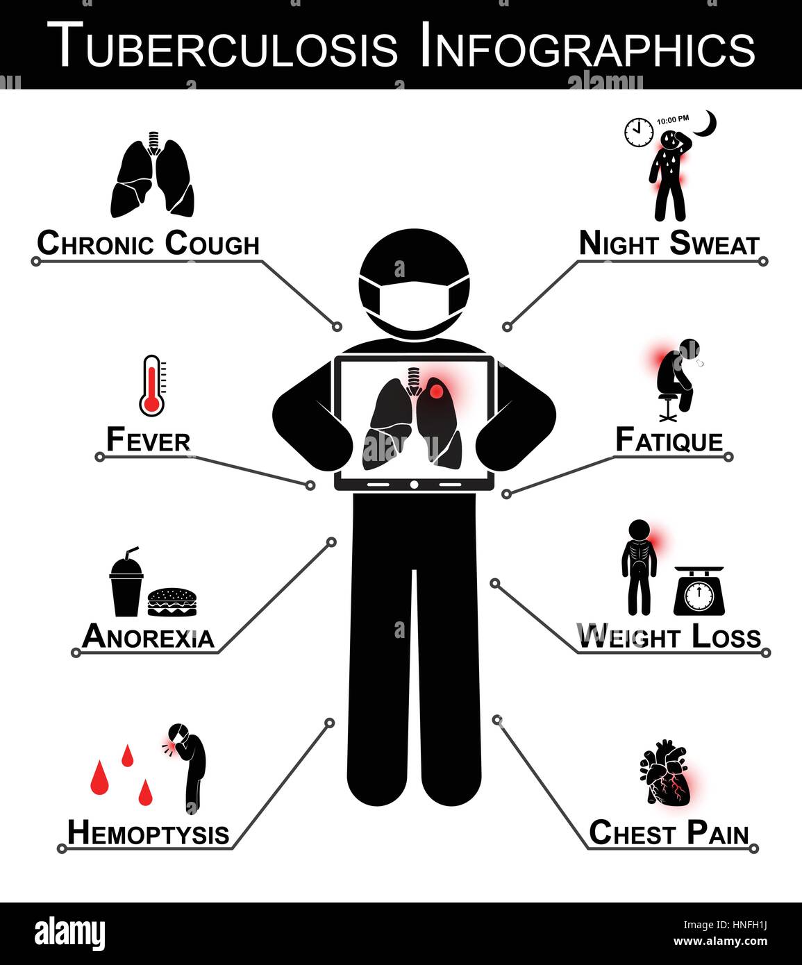 Tuberkulose (TB) Infografiken (Tuberkulose Symptom: chronischer Husten, Nachtschweiß, Fieber, Müdigkeit, Appetitlosigkeit, Gewichtsverlust, Hämoptysen, Brust Stock Vektor