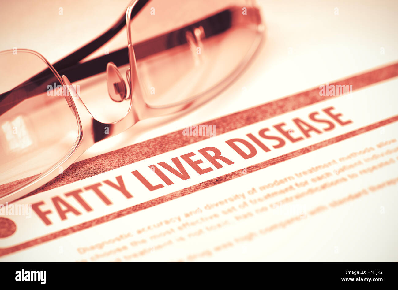 Fettleber. Medizin. 3D Illustration. Stockfoto
