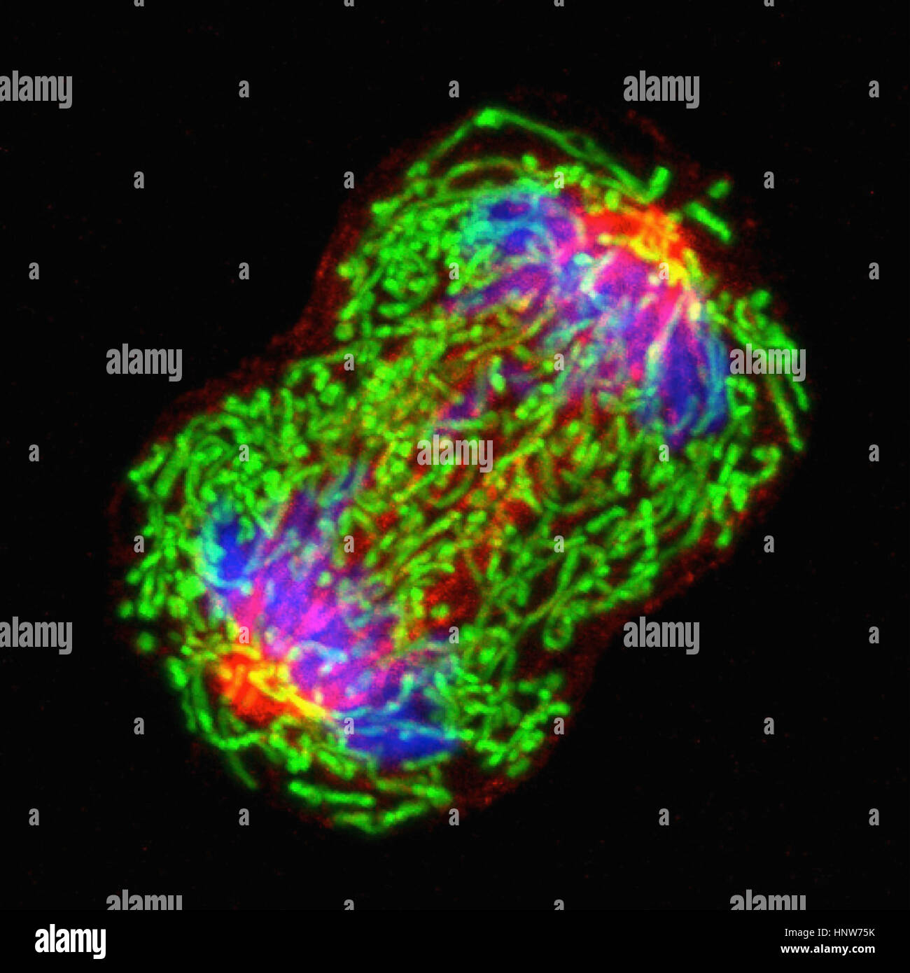 Mikroskopische Bild Brust Krebszelle teilen Stockfoto