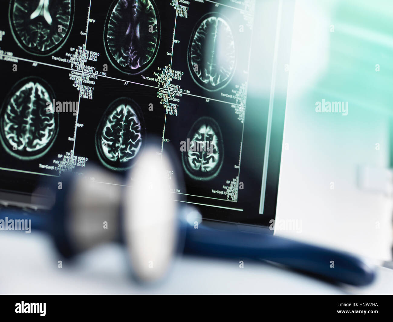 Reihe von MRI Gehirn-Scans auf Computer-Bildschirm mit Stethoskop im Vordergrund auf Schreibtisch des Arztes Stockfoto