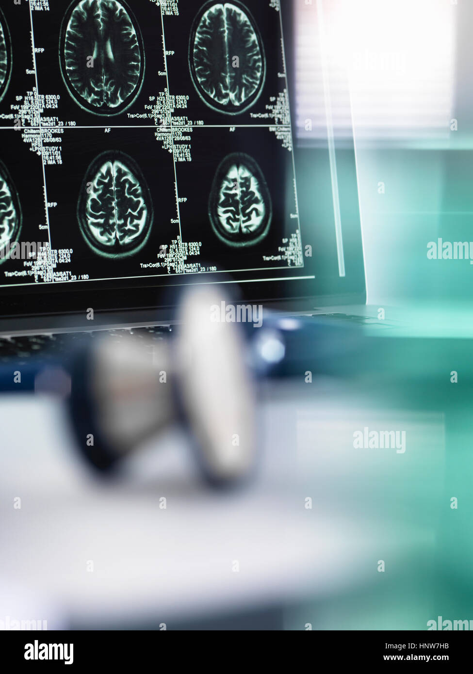 Reihe von MRI Gehirn-Scans auf Computer-Bildschirm mit Stethoskop im Vordergrund auf Schreibtisch des Arztes Stockfoto