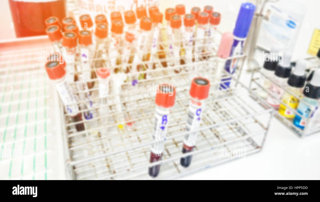 Abstrakte unscharfer Hintergrund von Blut Probenröhrchen für Tests im Labor. Stockfoto