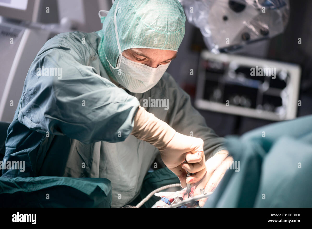 Neurochirurg Schrauben die Schädelknochen während einer operation Stockfoto