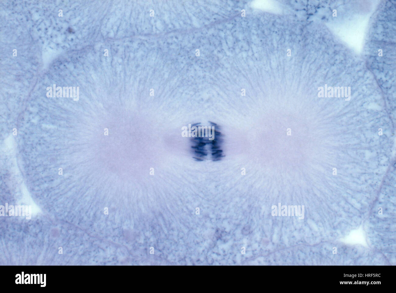 Felchen Zellen in Anaphase, LM Stockfoto