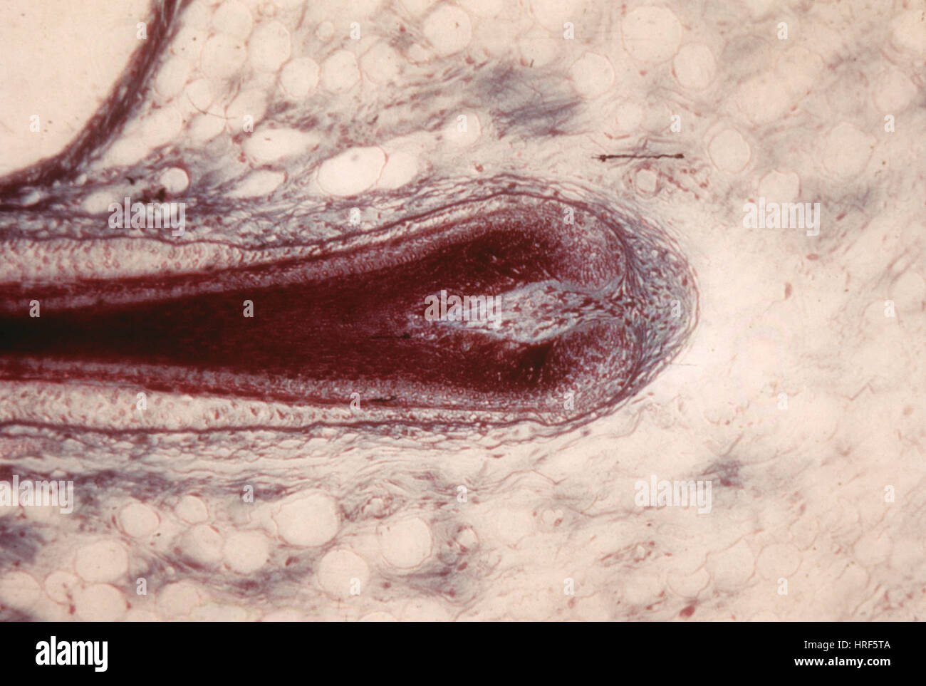 Haarfollikel Stockfoto Haarfollikel Stockfoto