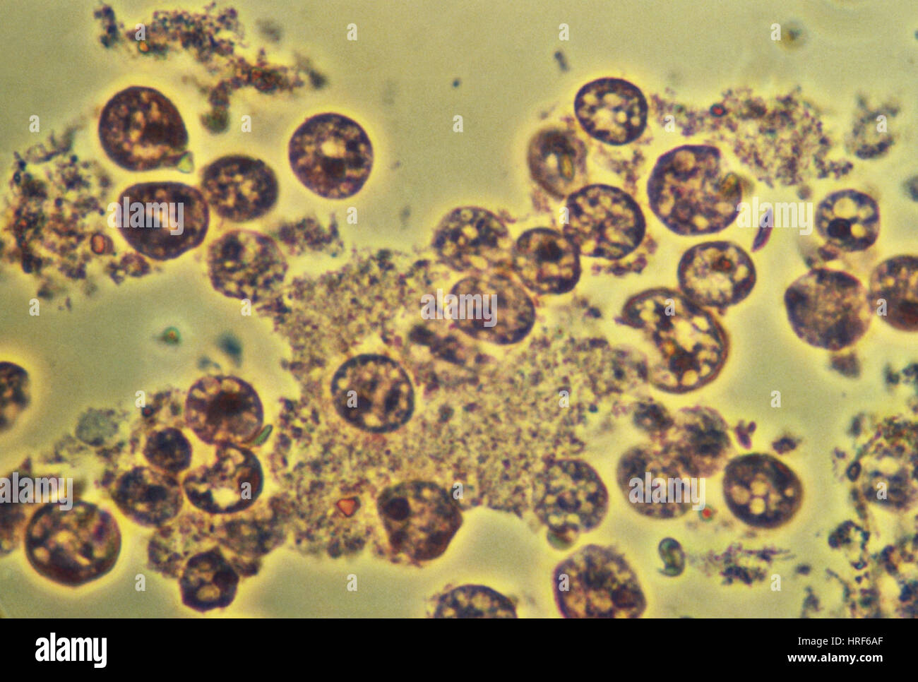 Entamoeba Histolytica (LM) Stockfoto