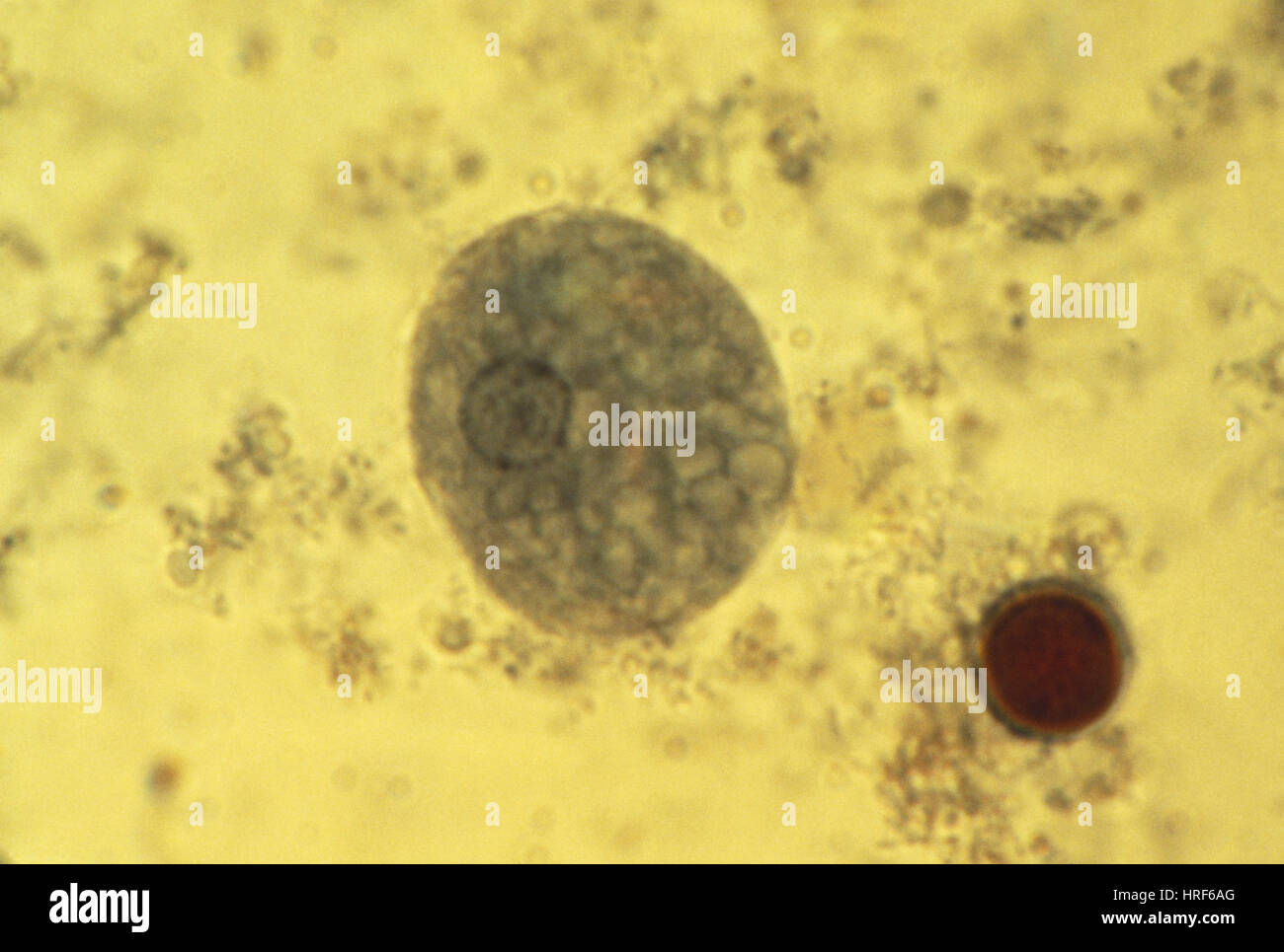 Entamoeba Histolytica (LM) Stockfoto