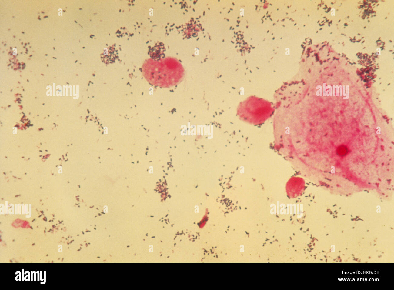 Trichomonas vaginalis Fotos und Bildmaterial in hoher Auflösung Alamy