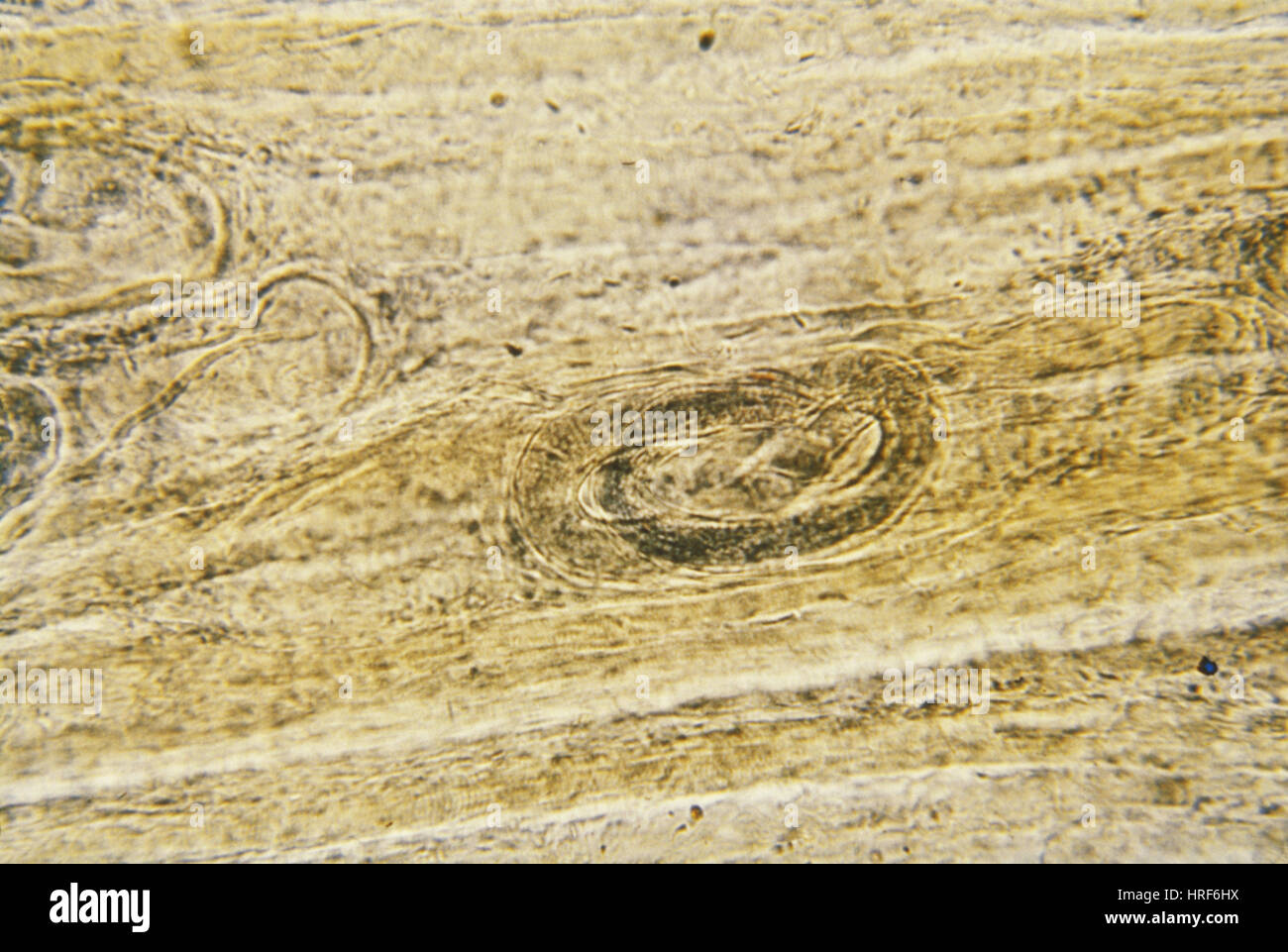 Trichinella spiralis Fotos und Bildmaterial in hoher Auflösung Alamy