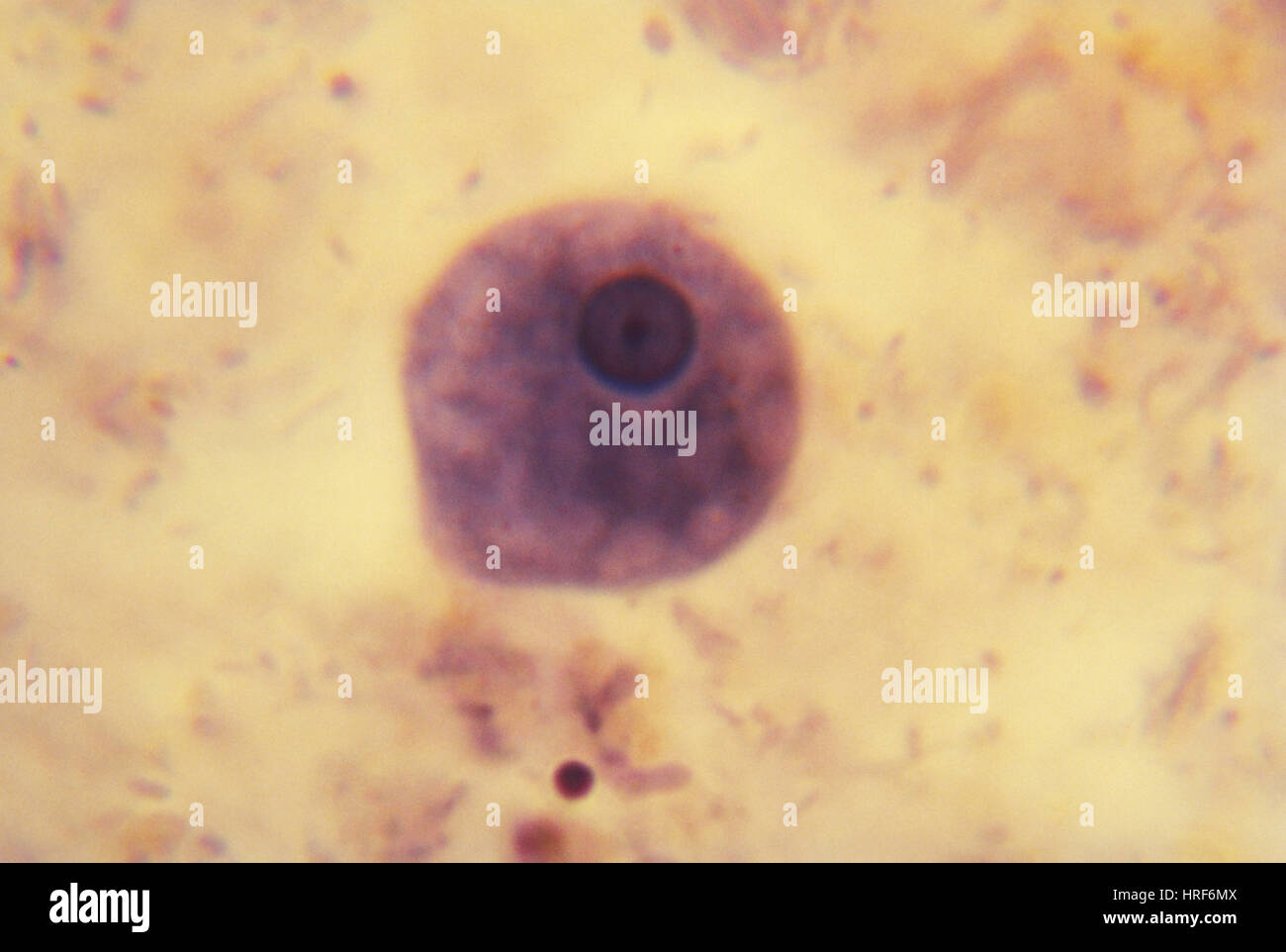 Entamoeba Histolytica (LM) Stockfoto