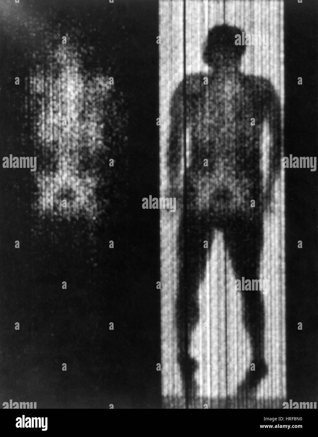 Verteilung der roten Zelle bilden Gewebe Stockfoto