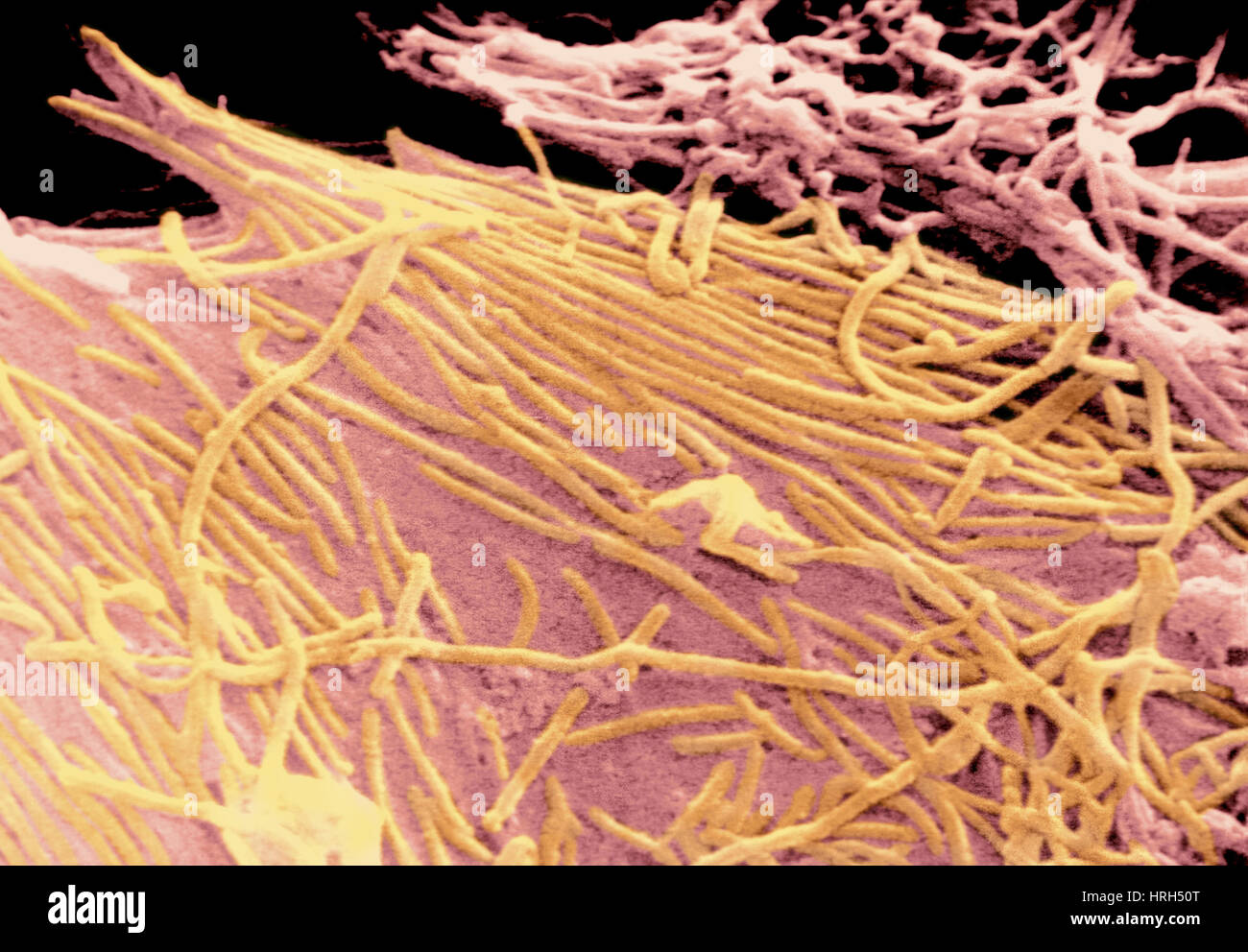 Ebola-Virus, SEM Stockfoto