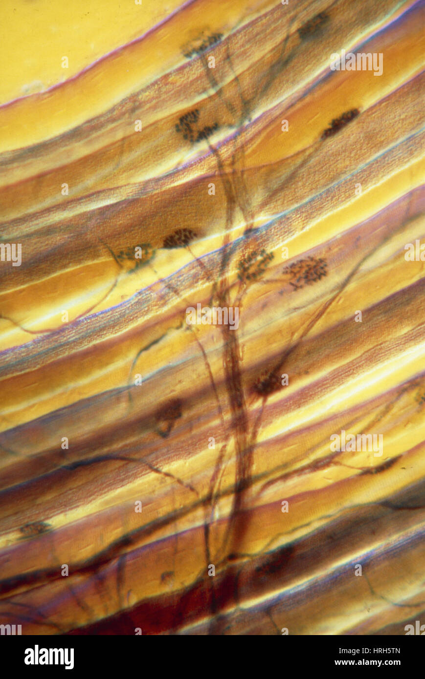 LM: Synapsen zwischen Motoneuron & Muskelzellen Stockfoto