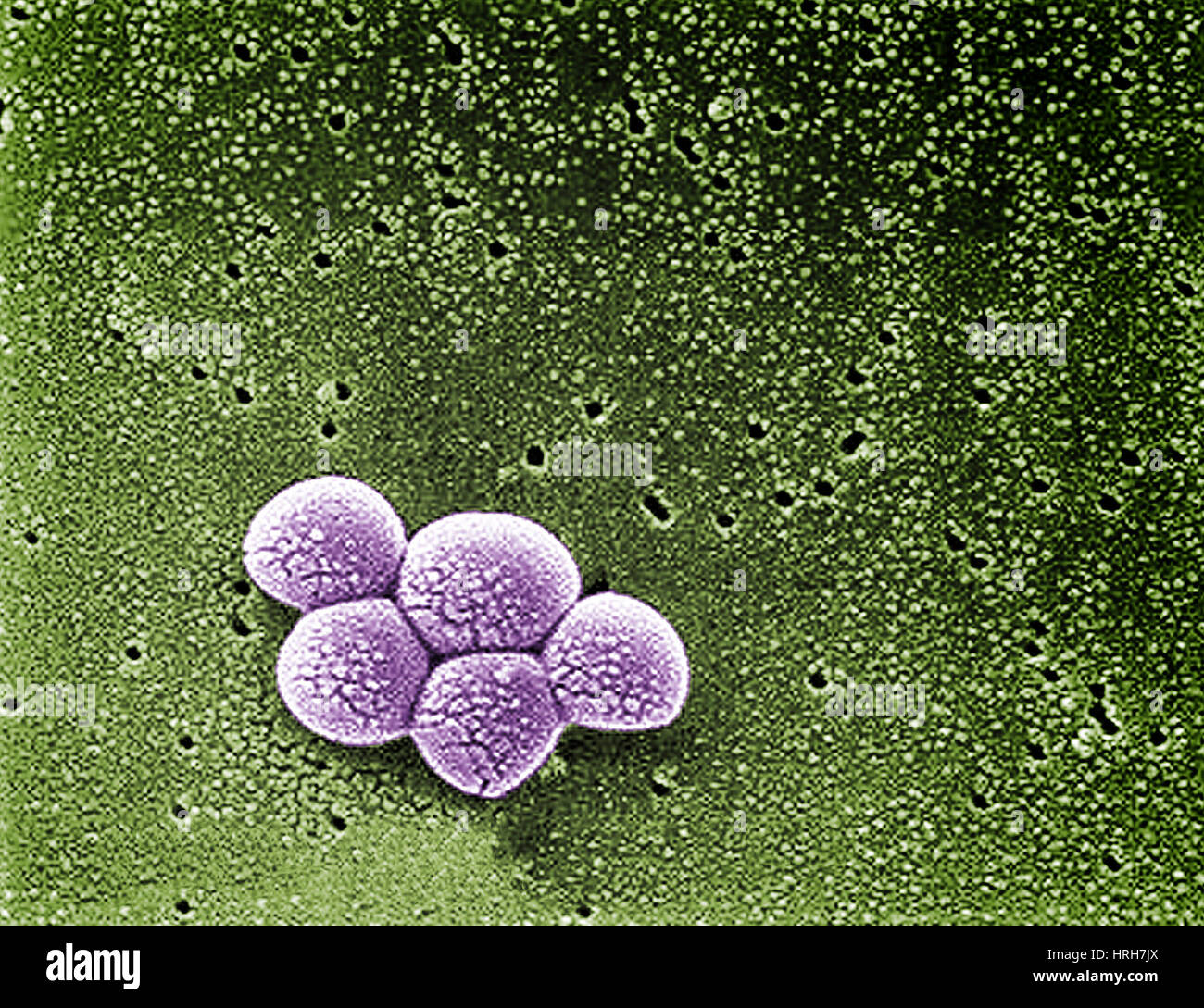 Staphylococcus Aureus Image Fotos Und Bildmaterial In Hoher Auflösung