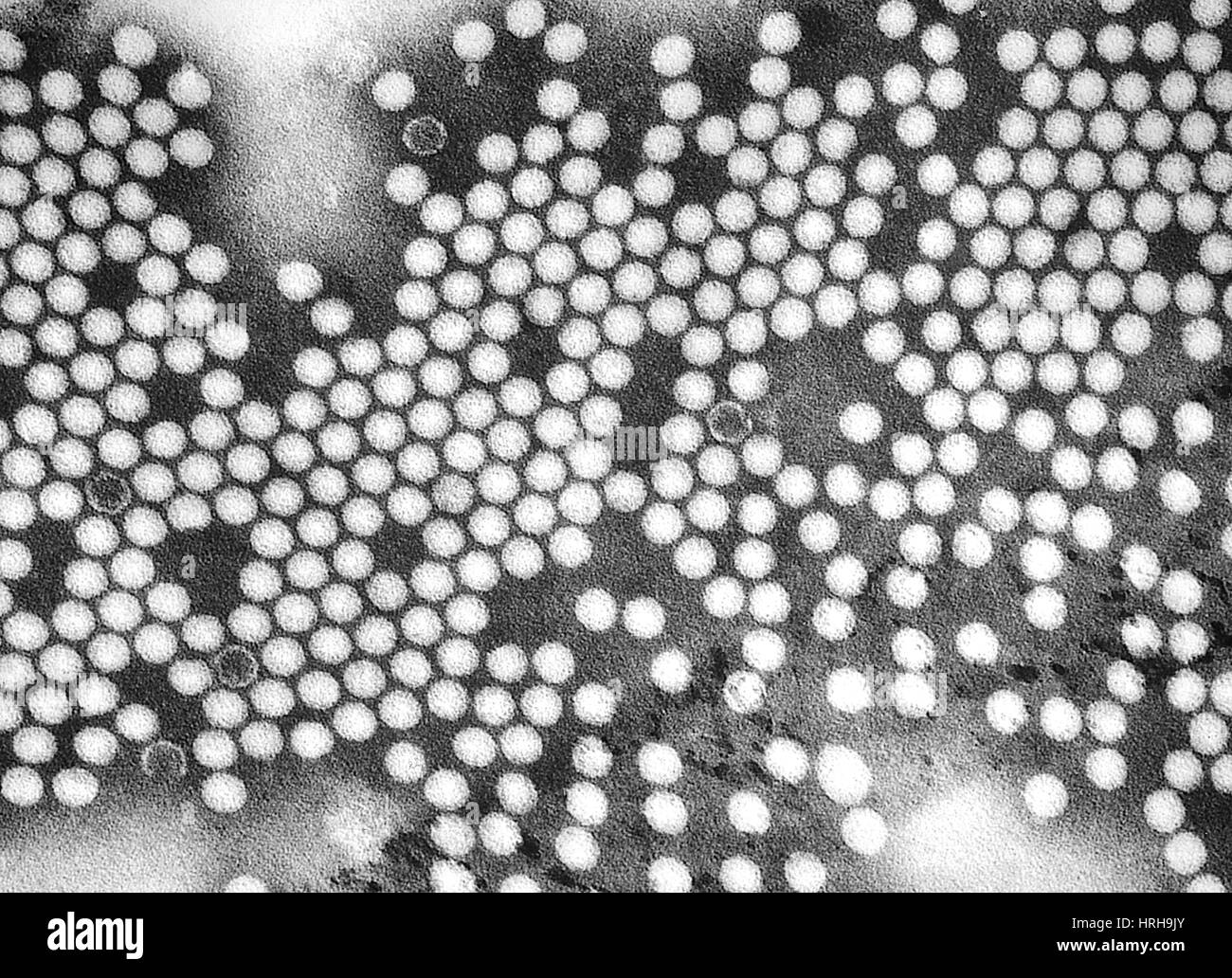 Polioviren, TEM Stockfoto