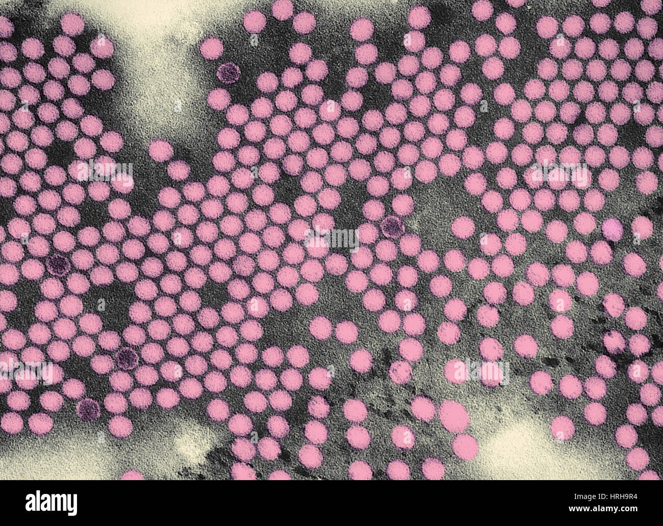 Polioviren, TEM Stockfoto