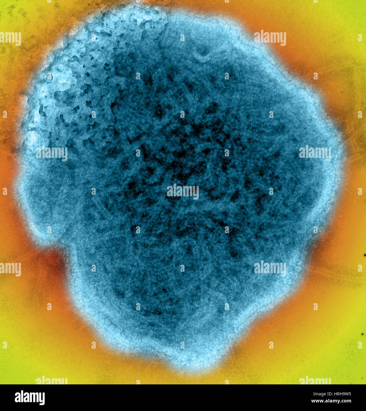 Mumps virus tem Fotos und Bildmaterial in hoher Auflösung Alamy