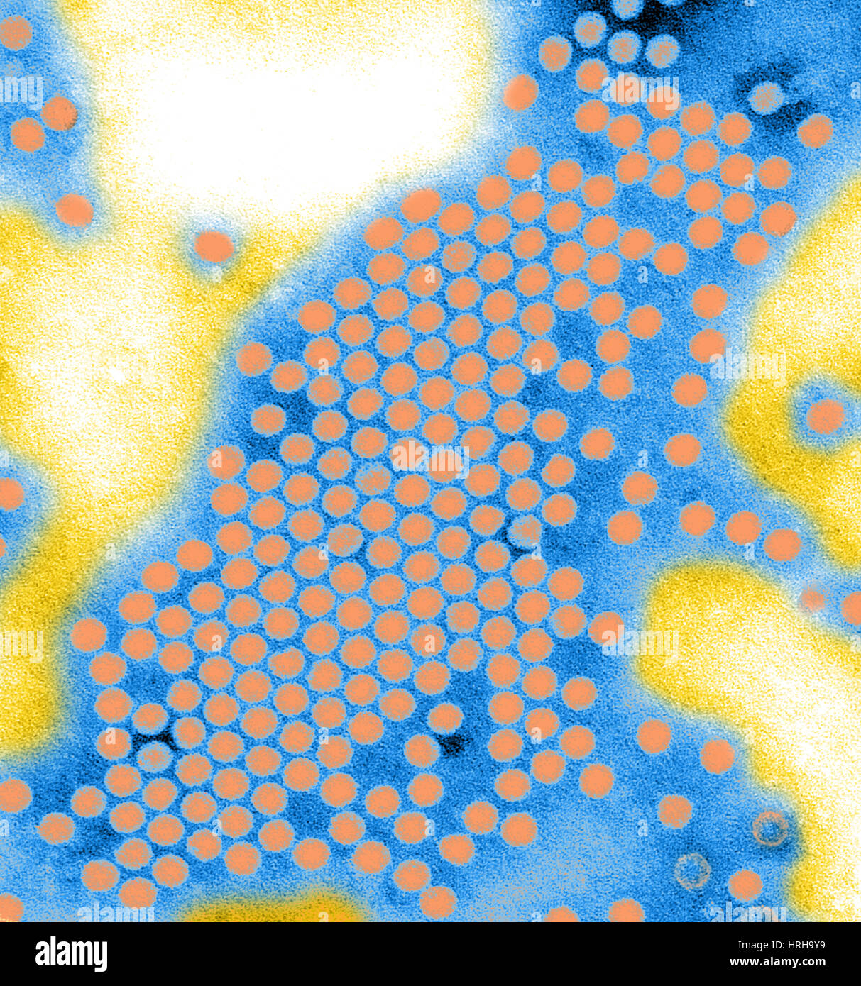 Poliovirus Typ 1, TEM Stockfoto