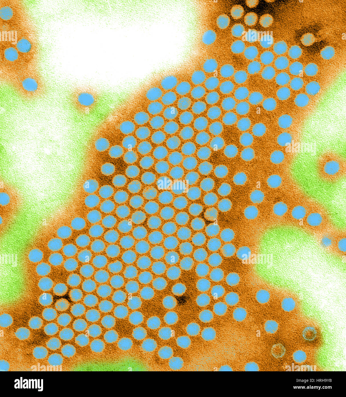 Poliovirus Typ 1, TEM Stockfoto