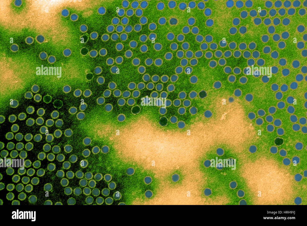 Polioviren, TEM Stockfoto