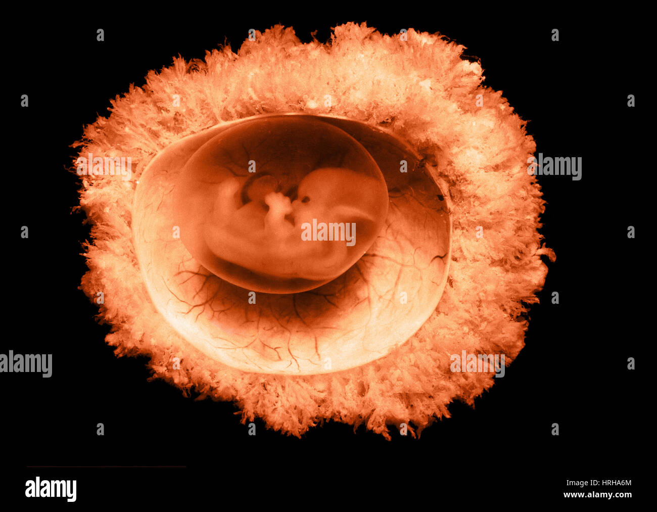 45 Tage alten menschlichen Embryos Stockfoto