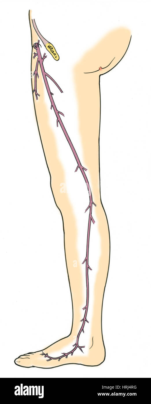 Illustration der großen Stammvenen Stockfoto