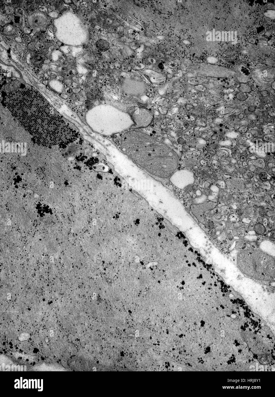 Coxsackievirus infektion -Fotos und -Bildmaterial in hoher Auflösung