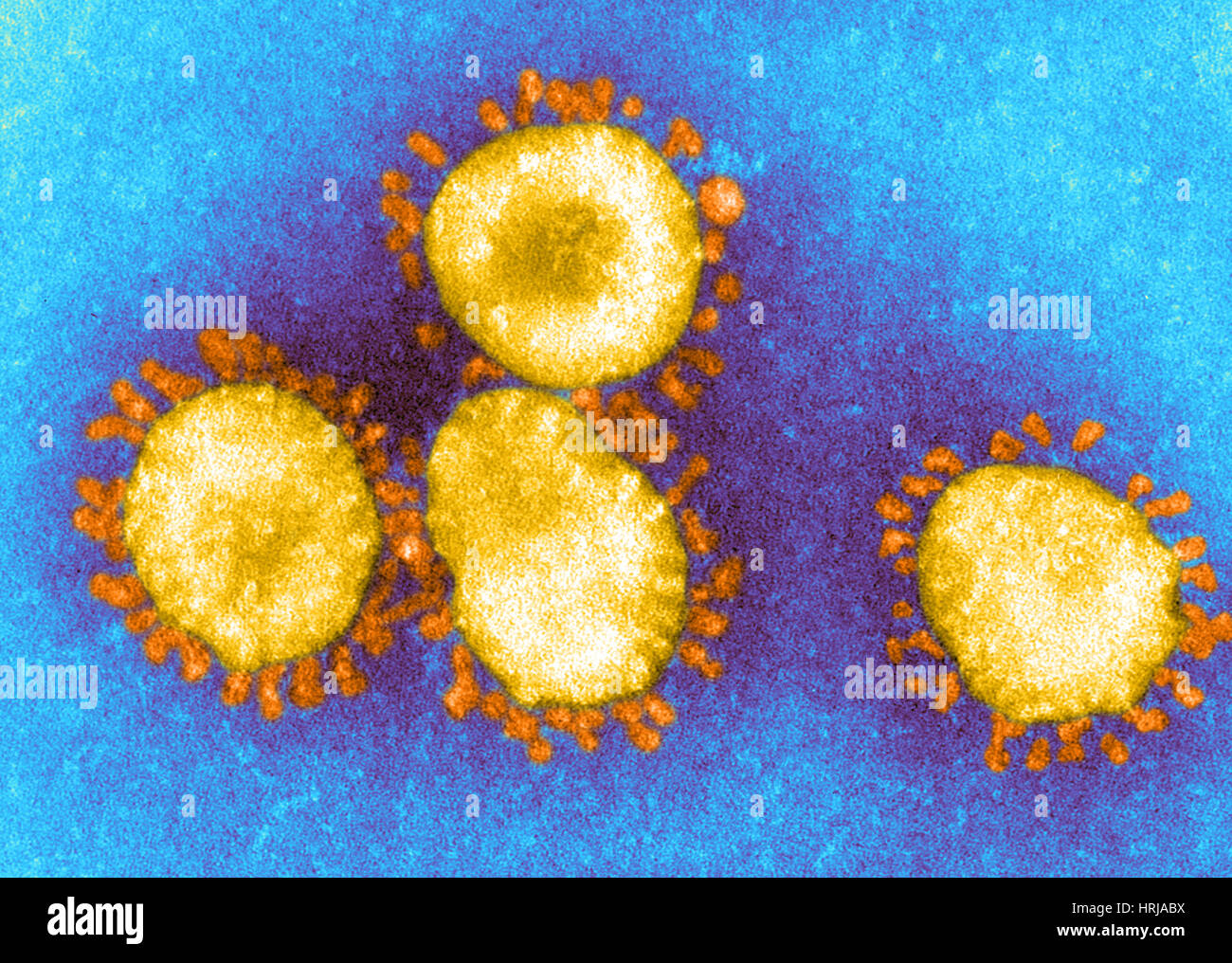SARS-Coronavirus, EM Stockfoto