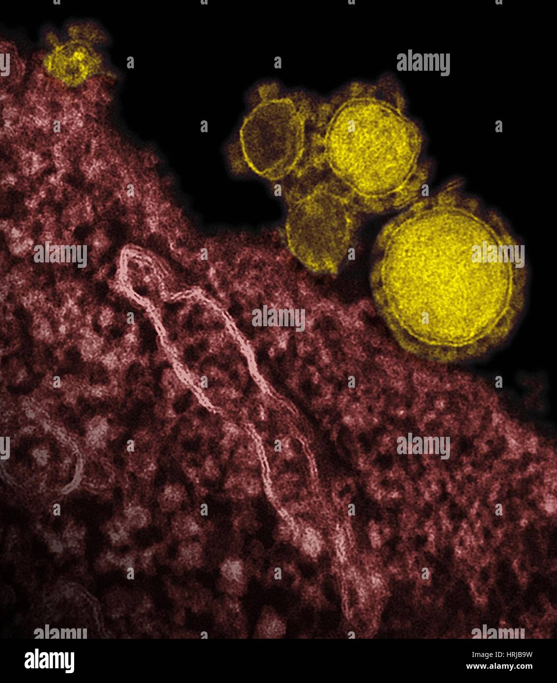 MERS-CoV (Nahost respiratorisches Syndrom Coronavirus) Stockfoto