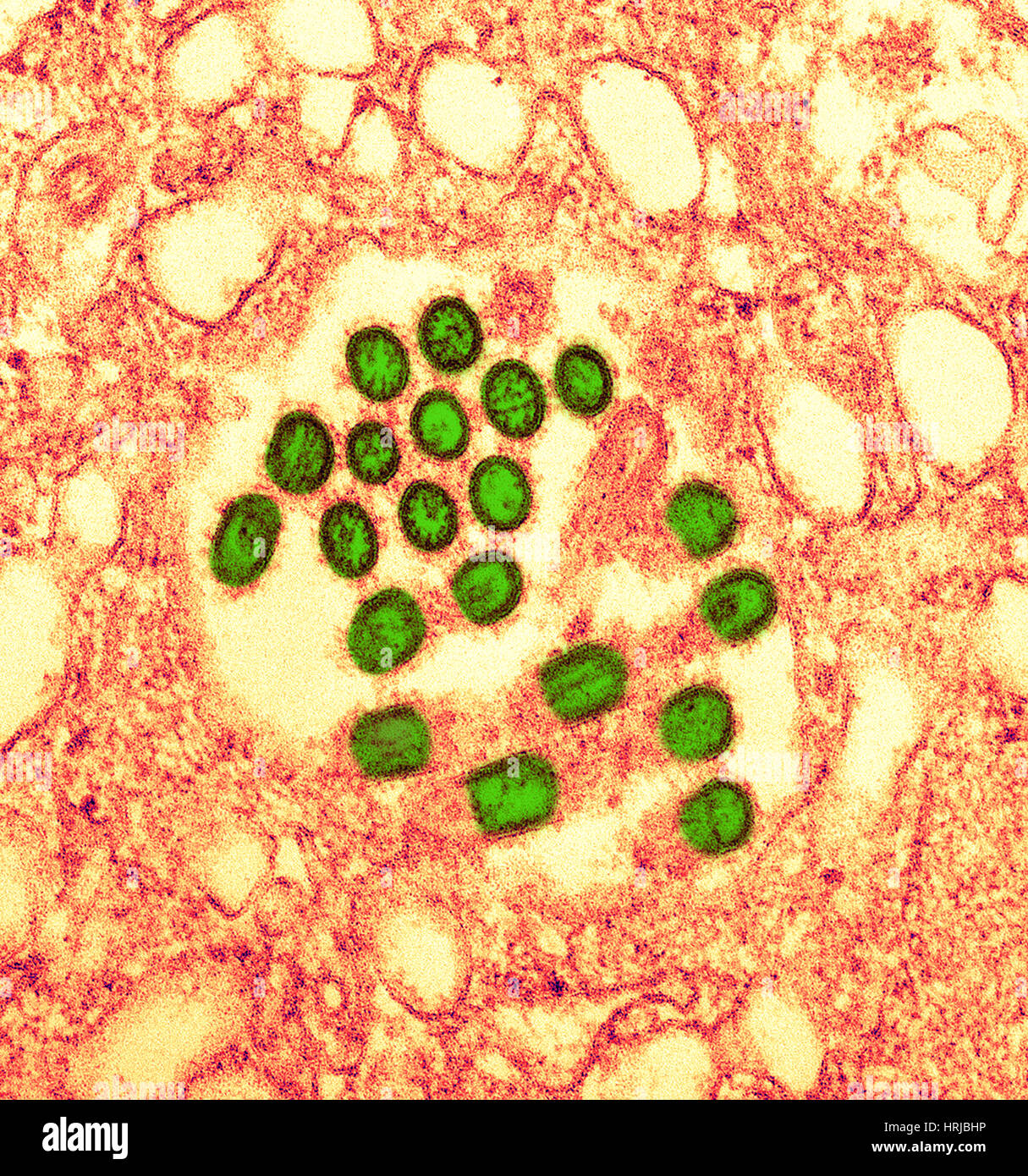 Neuartige H1N1-Virus, TEM Stockfoto