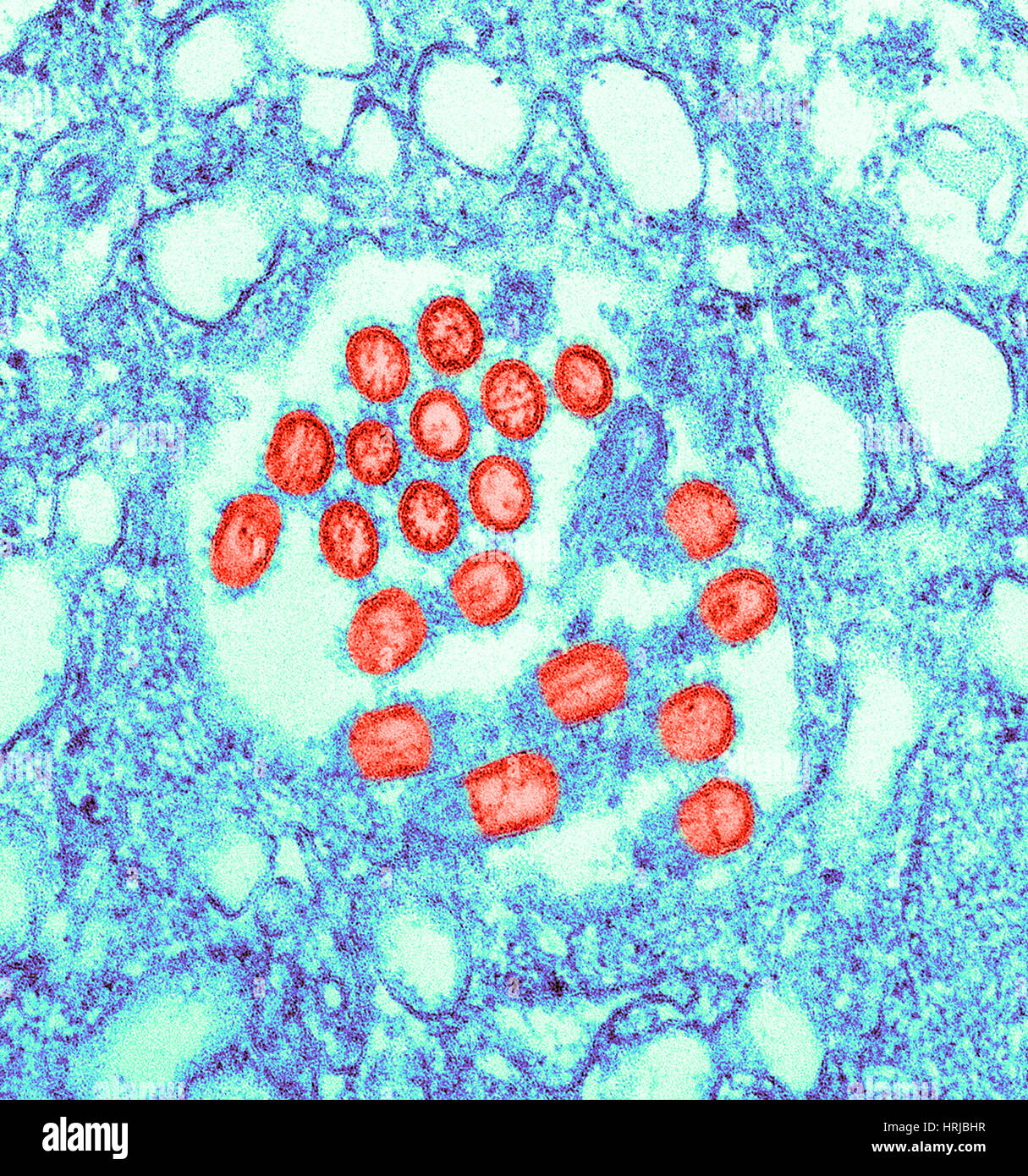 Neuartige H1N1-Virus, TEM Stockfoto