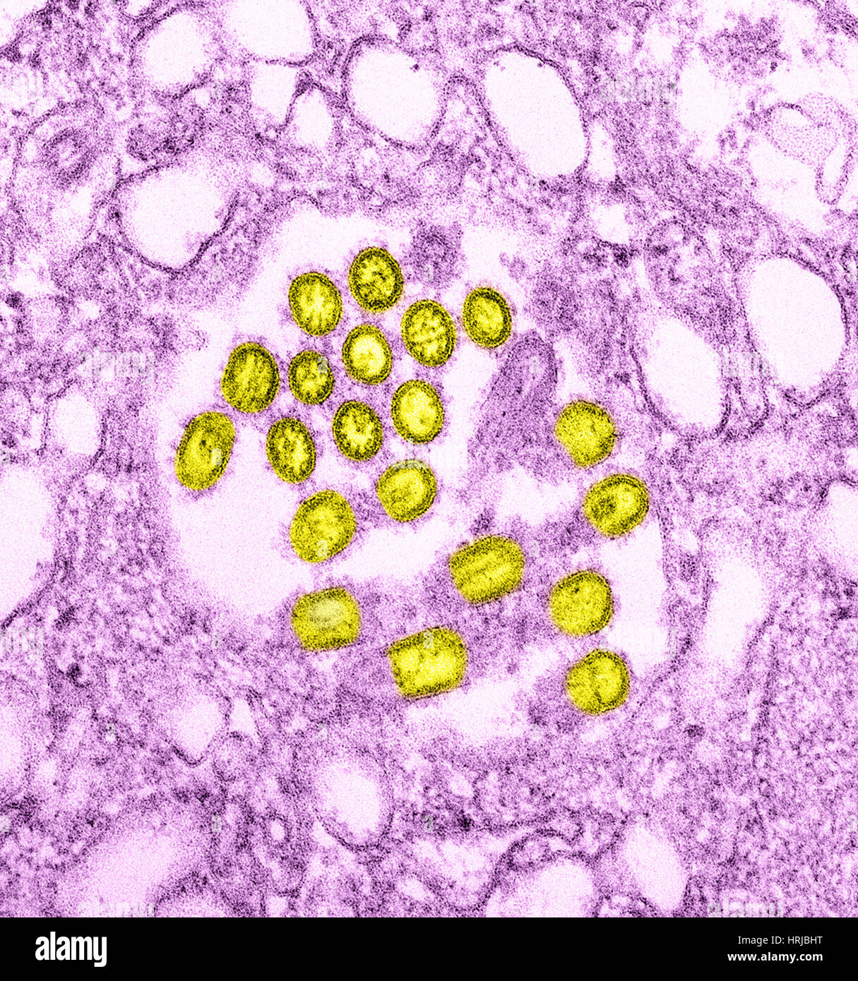 Neuartige H1N1-Virus, TEM Stockfoto