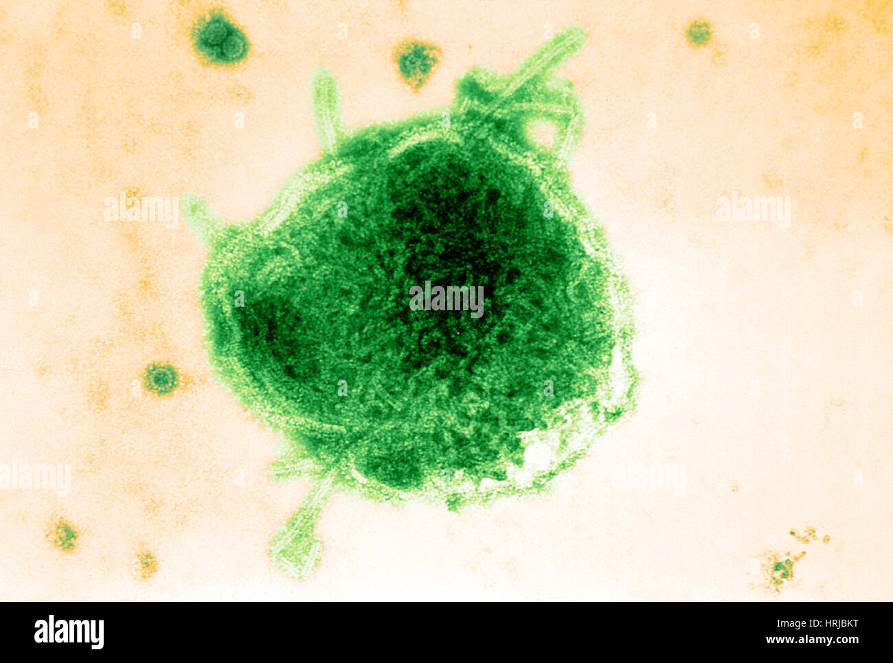 Masern und Simian Virus, TEM Stockfoto