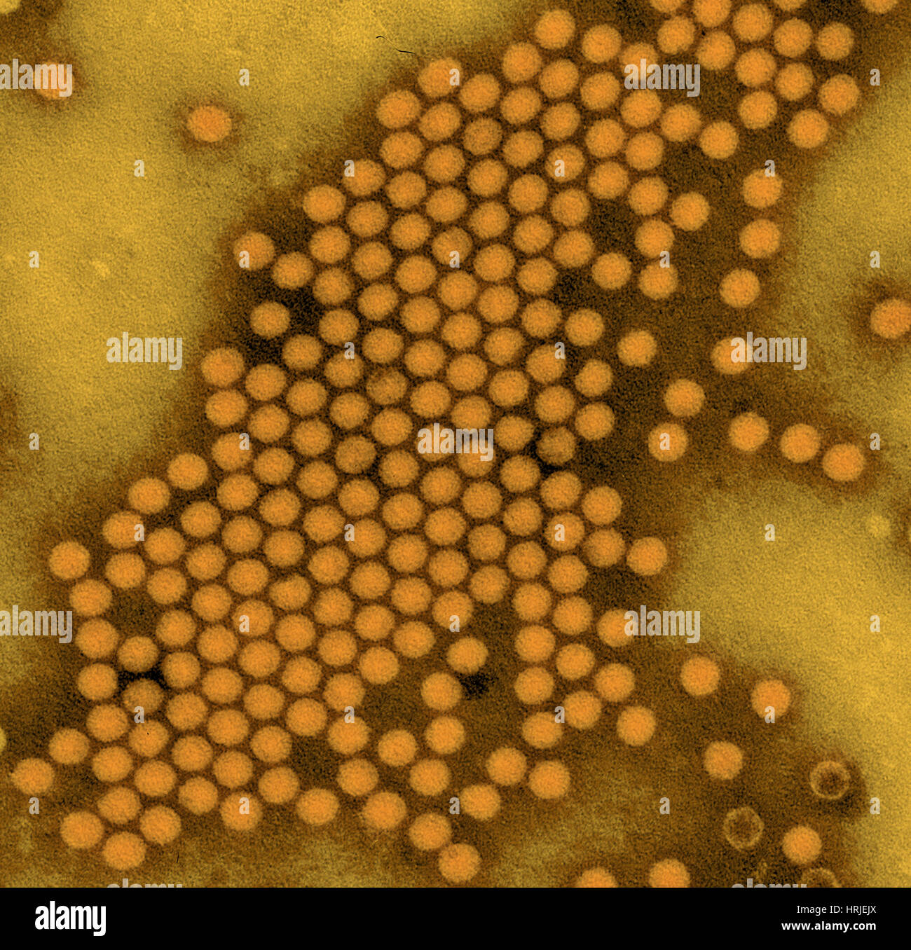 Polioviren, TEM Stockfoto