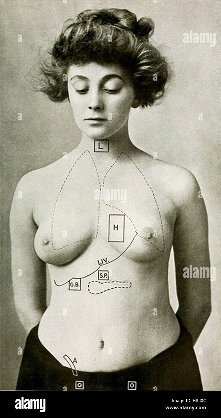 Elektro-Therapeutika, 1910 Stockfoto