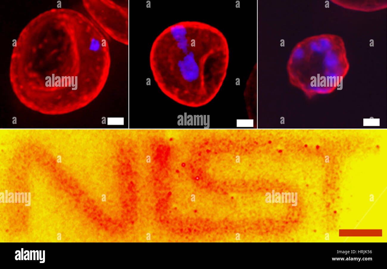 Quantum Dots, Malaria Progression, SEM Stockfoto