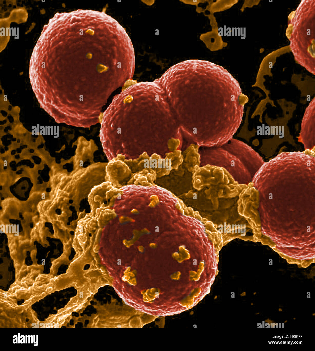 Neutrophilen, die Einnahme von MRSA-Bakterien, SEM Stockfoto