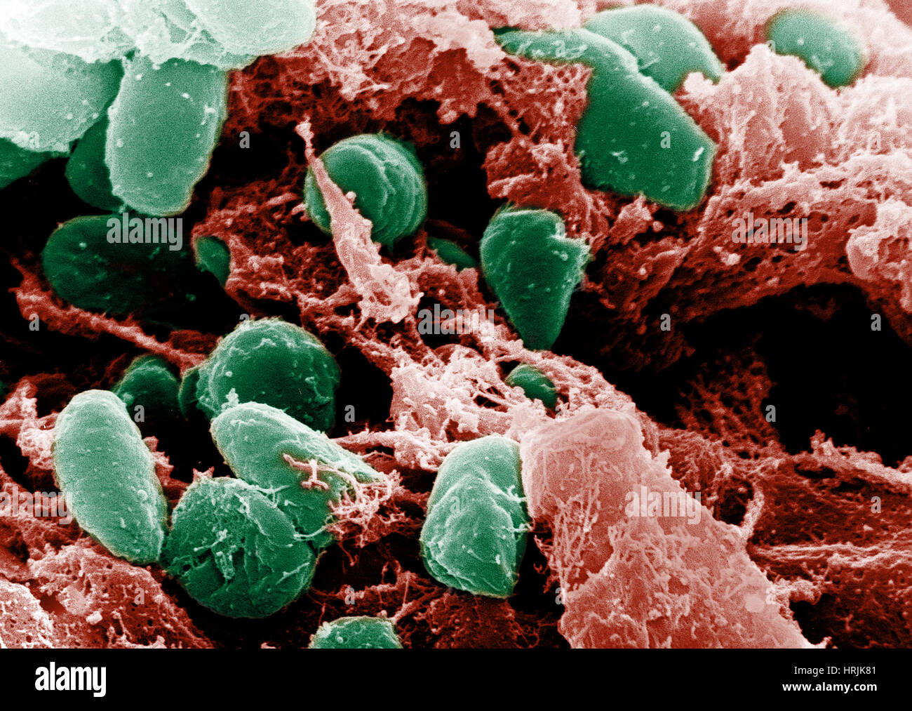 Чумная палочка микроскопия. Чумная палочка электронная микроскопия. Yersinia pestis чумная палочка. Чума под микроскопом. Чума под микроскопом.