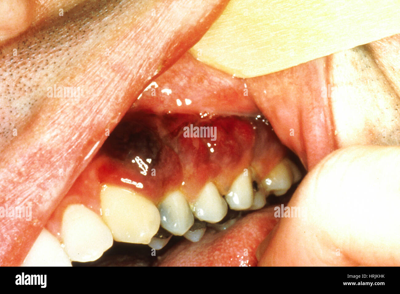 Stockfotos &amp; Bilder Alamy