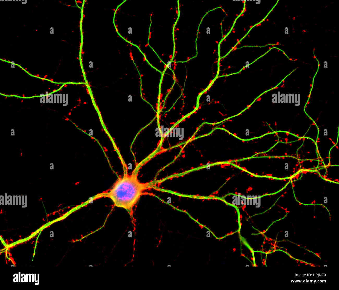 Hippocampal Neuronen in der Kultur Stockfoto